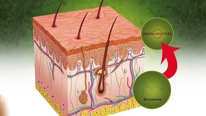 Learn why our body feels itchy and why scratching an itch makes it worse