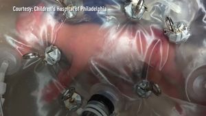 Know about a research experiment using premature lambs to create a biobag that acts as an artificial womb which can help take care of premature babies