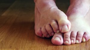 Discover the various factors that contribute to foot odors and ways to prevent it