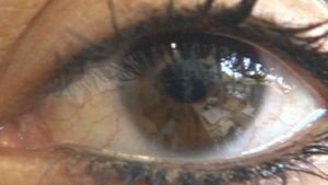 View an animation to understand the science behind nearsightedness (myopia) and farsightedness (hyperopia)