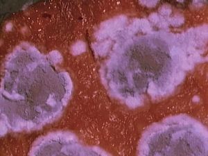 Notice the growth of Penicillium and yeast