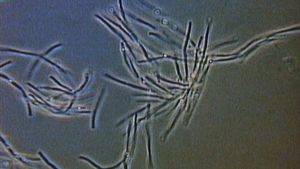 Understand how pathogenic bacteria can cause botulism, typhoid, cholera, and pneumonia