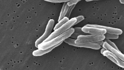 Know why tuberculosis still poses a threat to humans and why the fight against this disease is far from over